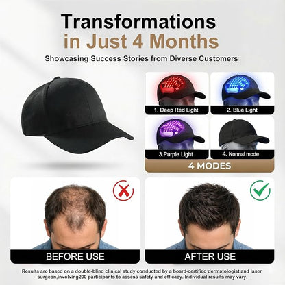 dht™⭐Regrow Thicker Hair Red Light Therapy Hair Cap