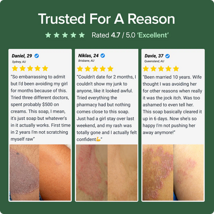 Antifungal Soap