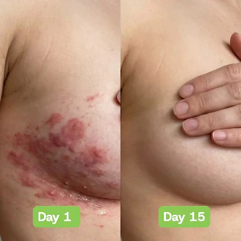 Natural Organic Antifungal Soap