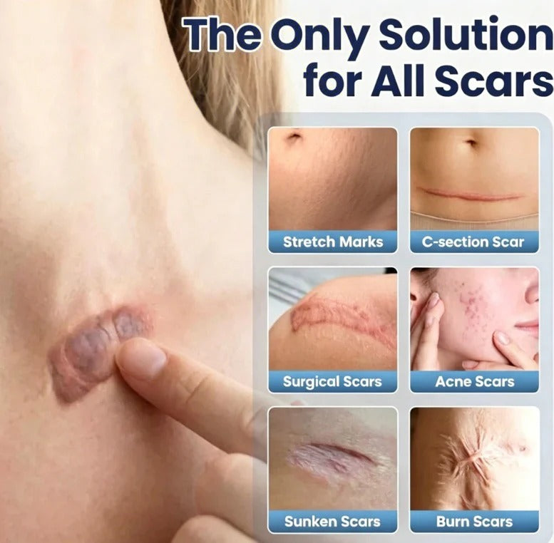 Rapid Scar Fading Repair Cream, Deep Nourishing Skin Smooth Recovery Treatment