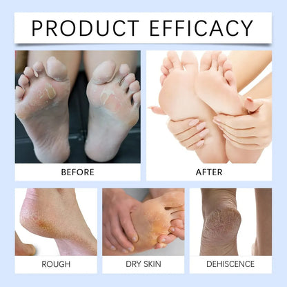 Anti-Crack Dry Foot Repair Roller, Refreshing Non-Greasy Moisturizing Foot Care