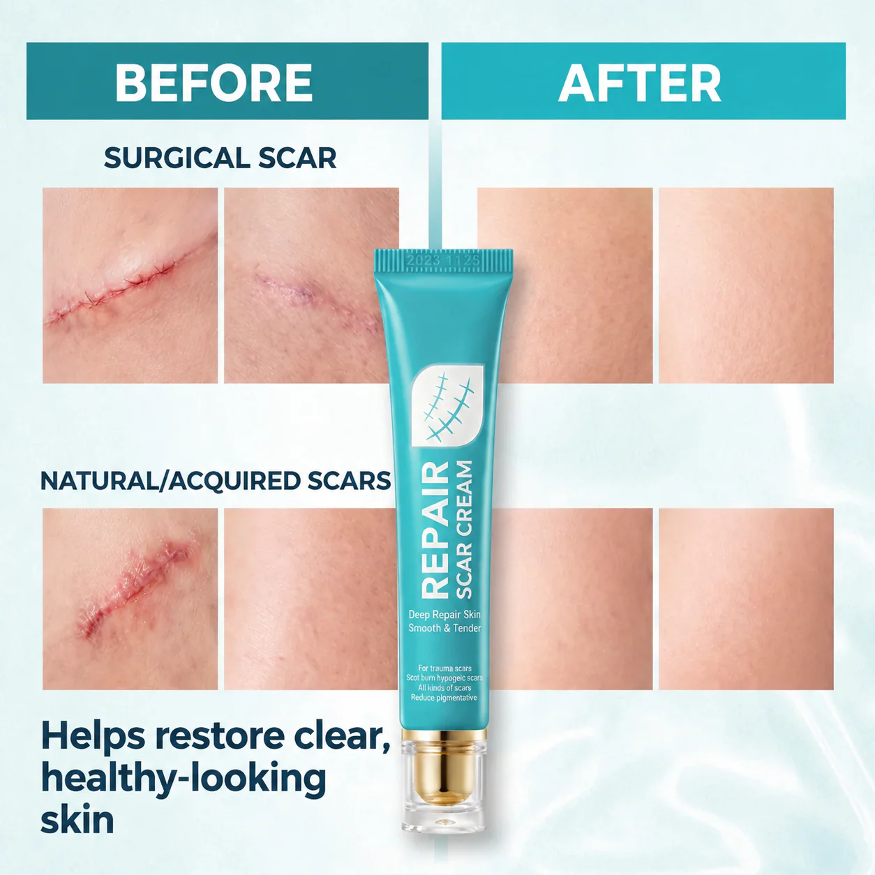 Rapid Scar Fading Repair Cream, Deep Nourishing Skin Smooth Recovery Treatment