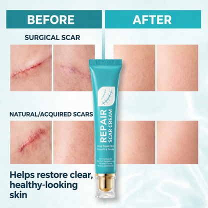Rapid Scar Fading Repair Cream, Deep Nourishing Skin Smooth Recovery Treatment