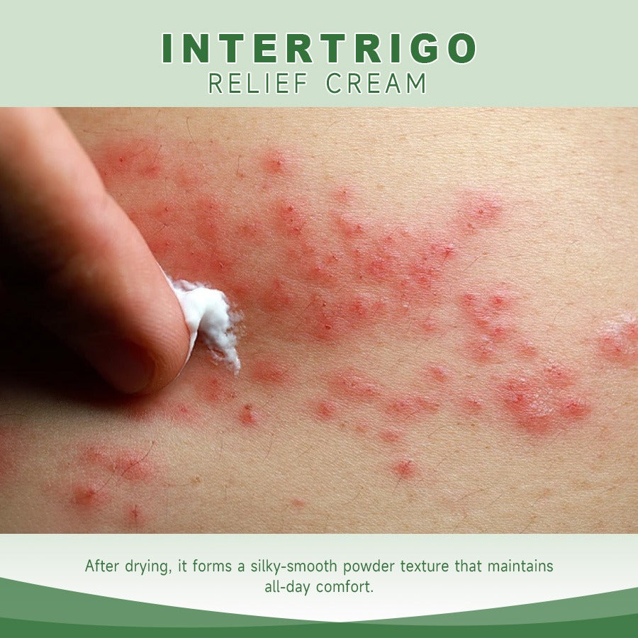 Intertrigo Relief Cream treats 99% of skin fold rashes from the first application