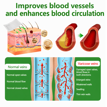14 Days Visible Vein Reduction Microneedle Patch, Pain-Free Leg Care