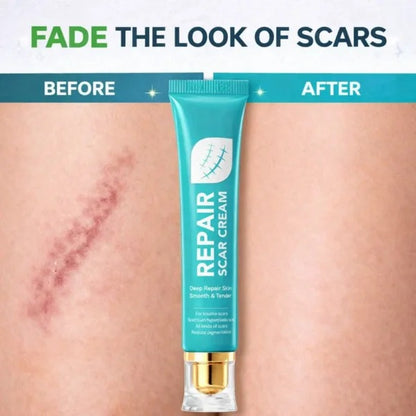 Rapid Scar Fading Repair Cream, Deep Nourishing Skin Smooth Recovery Treatment