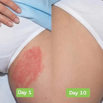 Natural Organic Antifungal Soap