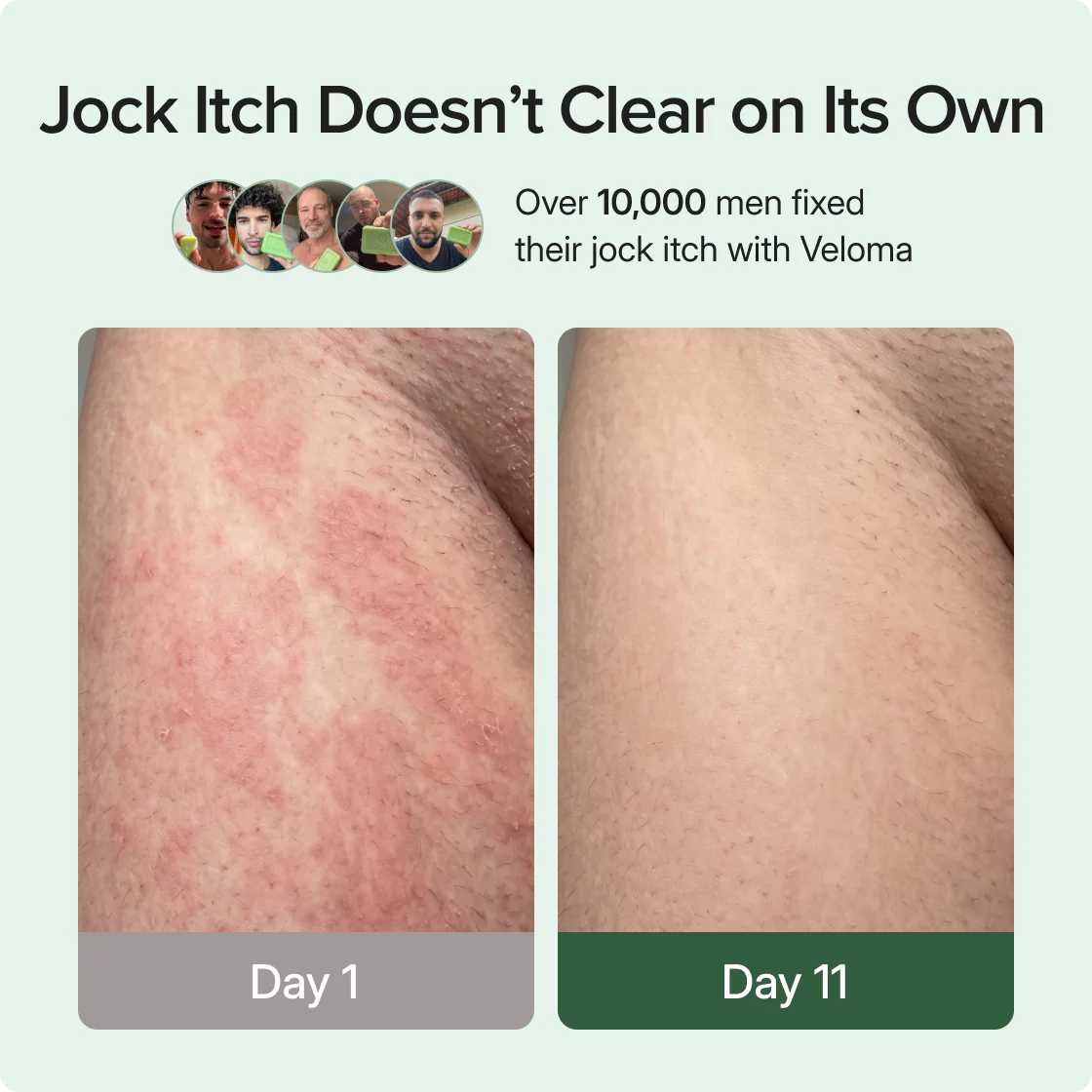 Antifungal Soap