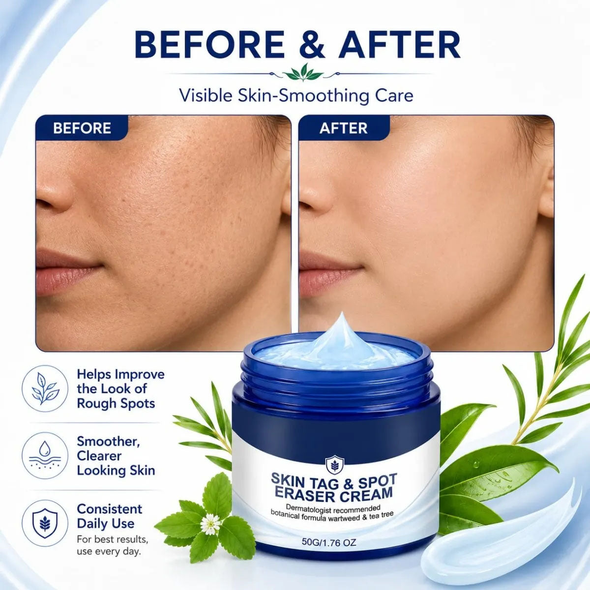 7‑Day Skin Tag & Spot Care Cream, Mild Non‑Irritating Formula